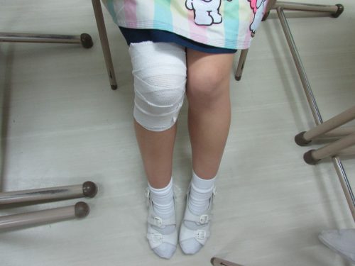 こども学専攻 1年次後期 の授業紹介 こどもの保健2 鹿児島純心女子短期大学 こども学専攻 1年次後期 の授業紹介 こどもの保健2 鹿児島純心女子短期大学